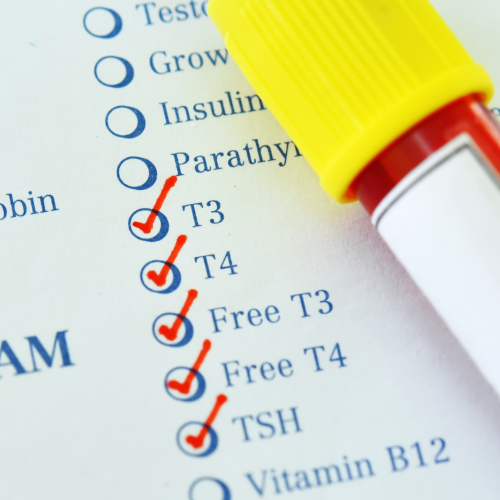 picture of lab tests for hormone balance