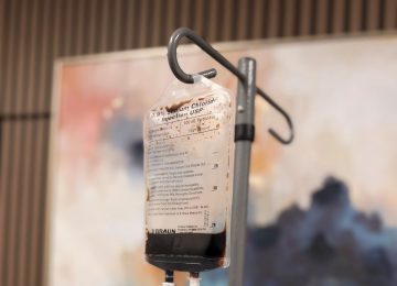 Iron infusion IV bag for iron deficiency treatment at IRON Infusions in Meridian, Idaho