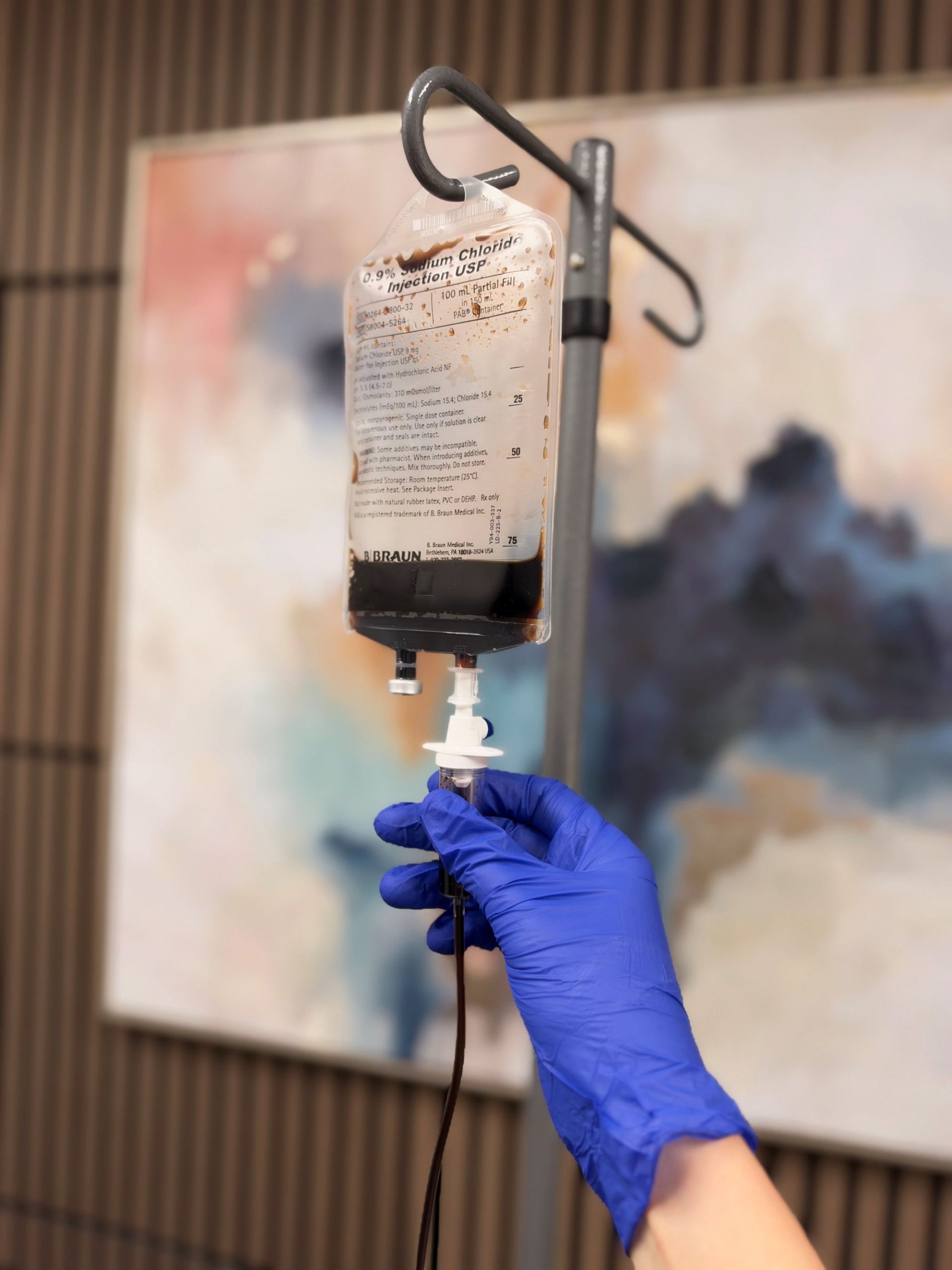 Iron infusion IV bag for iron deficiency treatment at IRON Infusions in Meridian, Idaho